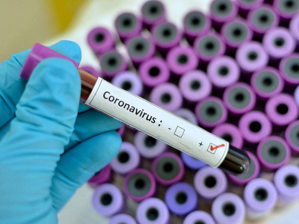 Центр общественного здоровья Минздрава забраковал тесты на коронавирус, закупленные Офисом президента