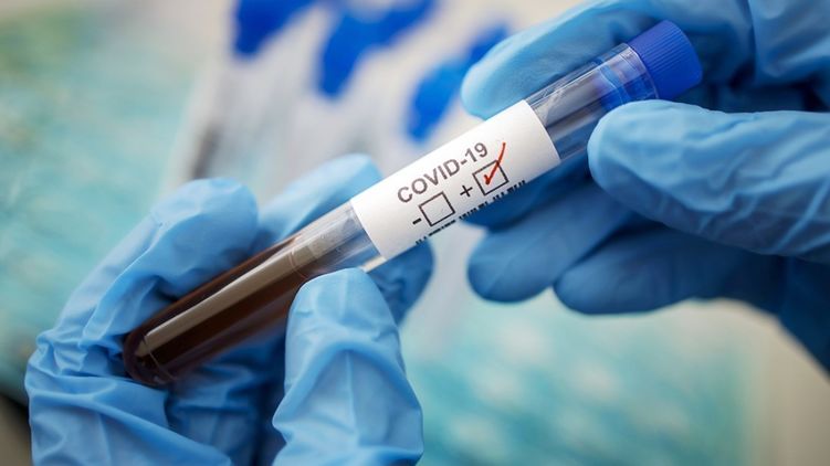 С диагнозом COVID-19 умер сотрудник Госпогранслужбы  
