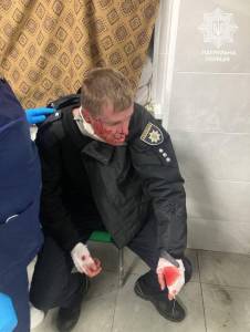 В Запоріжжі під час обстрілу постраждало четверо патрульних  