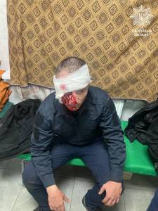 В Запоріжжі під час обстрілу постраждало четверо патрульних  