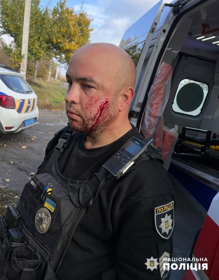 У Павлограді чоловік ножем поранив поліцейського