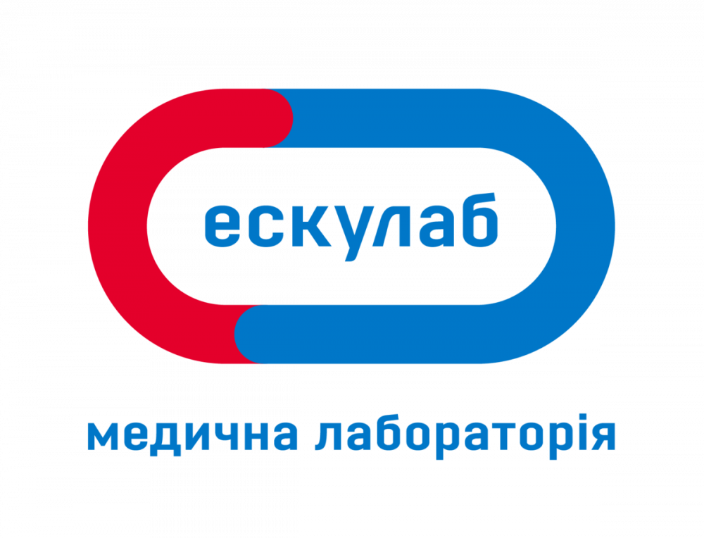 Мережу лабораторій «Ескулаб» перевіряють через ухилення від сплати податків